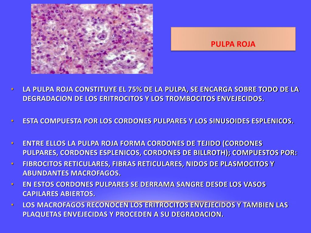 PULPA ROJA LA PULPA ROJA CONSTITUYE EL 75% DE LA PULPA, SE ENCARGA SOBRE TODO DE LA DEGRADACION DE LOS ERITROCITOS Y LOS TROMBOCITOS ENVEJECIDOS.