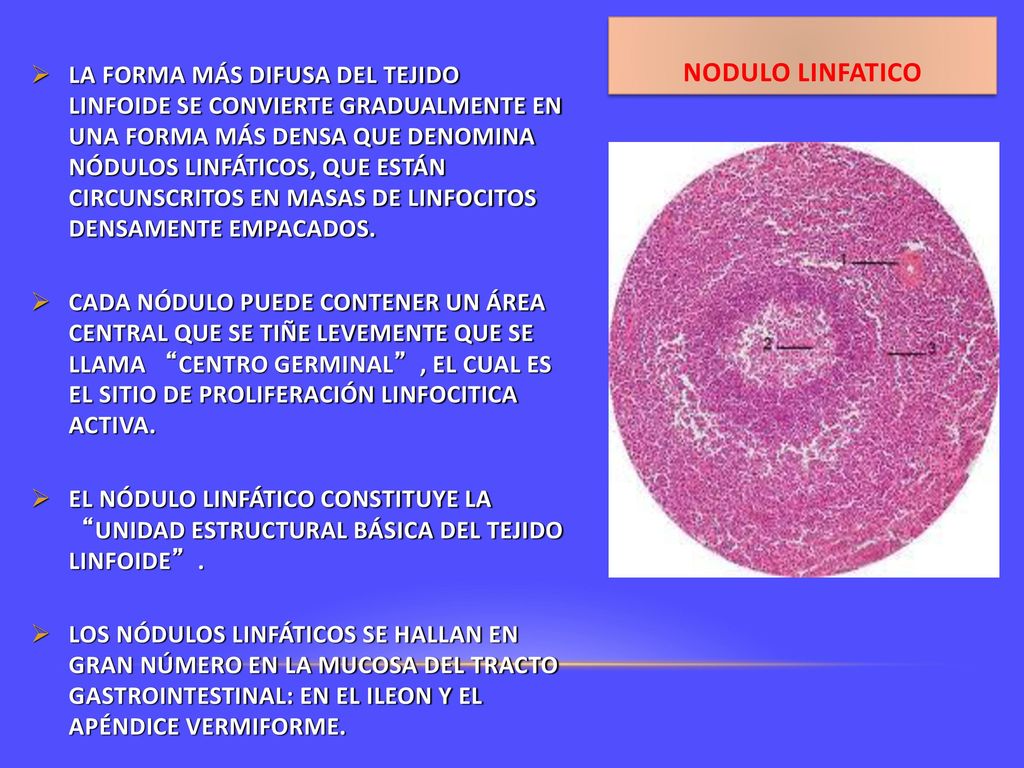 LA FORMA MÁS DIFUSA DEL TEJIDO LINFOIDE SE CONVIERTE GRADUALMENTE EN UNA FORMA MÁS DENSA QUE DENOMINA NÓDULOS LINFÁTICOS, QUE ESTÁN CIRCUNSCRITOS EN MASAS DE LINFOCITOS DENSAMENTE EMPACADOS.