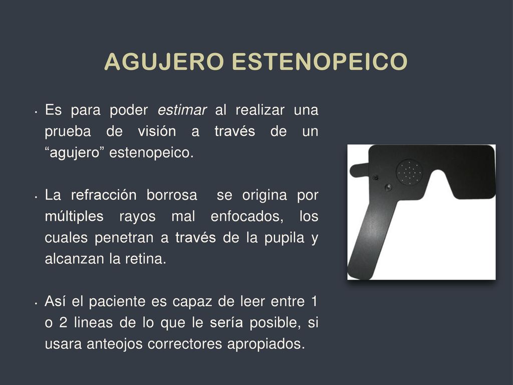 Agujero Estenopeico Es para poder estimar al realizar una prueba de visión a través de un agujero estenopeico.