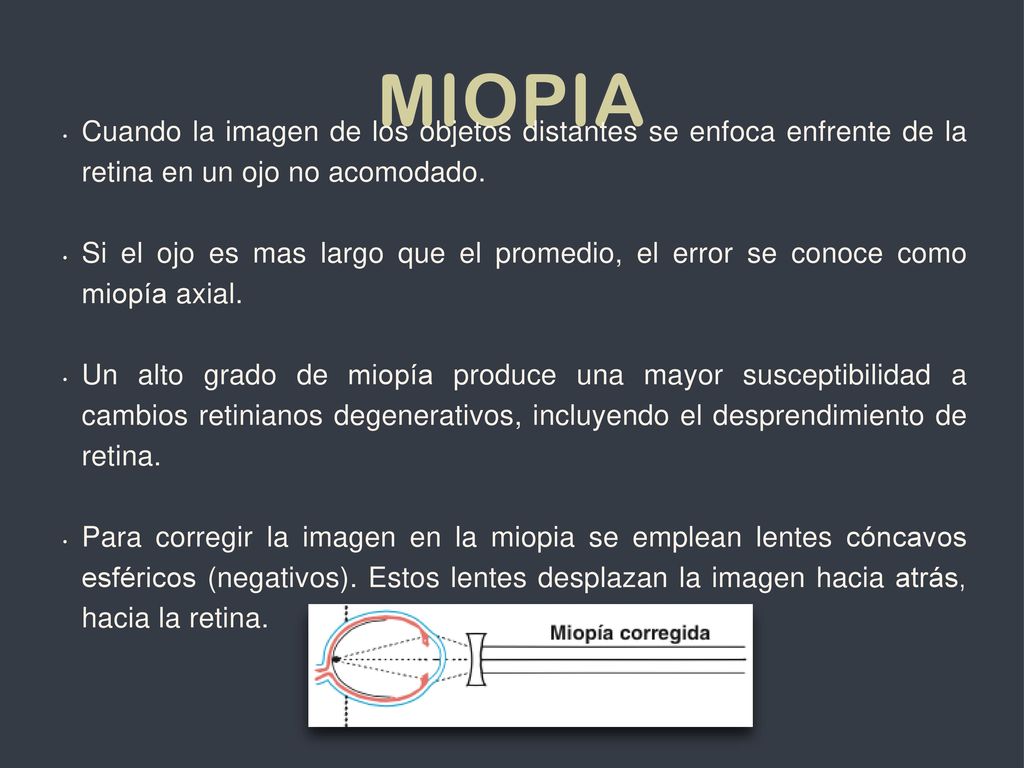 MIopia Cuando la imagen de los objetos distantes se enfoca enfrente de la retina en un ojo no acomodado.