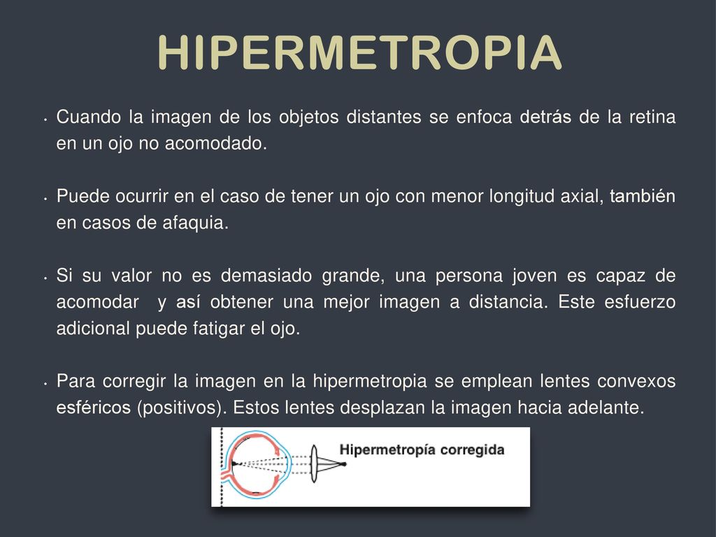 Hipermetropia Cuando la imagen de los objetos distantes se enfoca detrás de la retina en un ojo no acomodado.