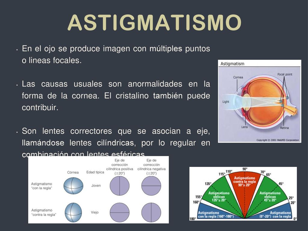 Astigmatismo En el ojo se produce imagen con múltiples puntos o lineas focales.