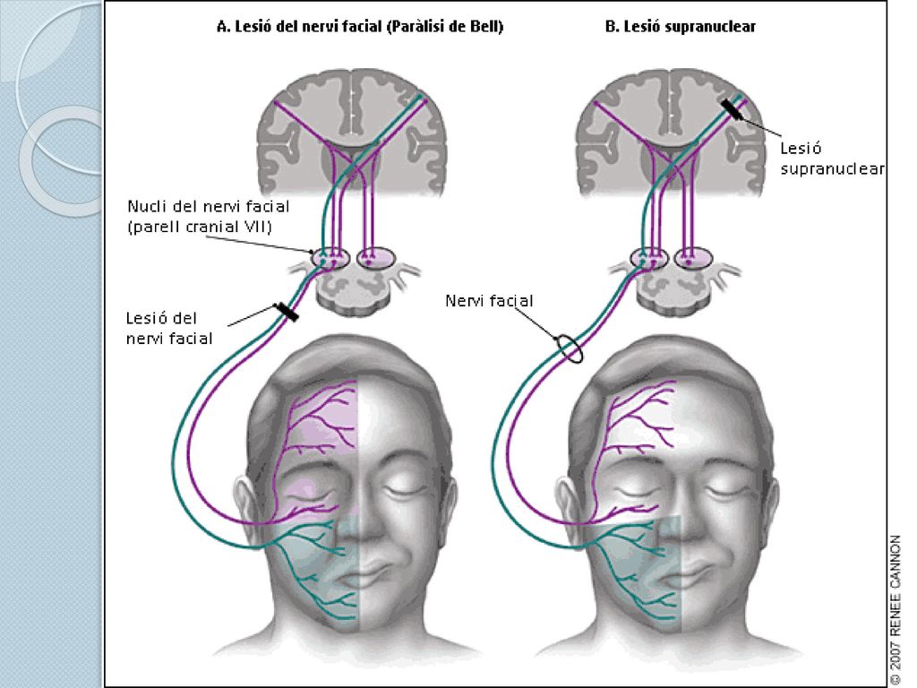 los músculos frontal y orbicular de los párpados, que poseen una inervación bilateral,