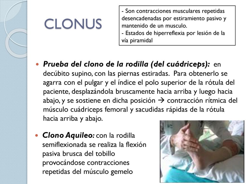 - Son contracciones musculares repetidas desencadenadas por estiramiento pasivo y mantenido de un musculo.