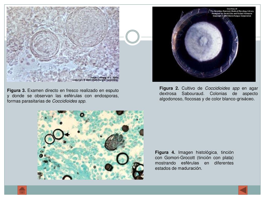 Figura 2. Cultivo de Coccidioides spp en agar dextrosa Sabouraud