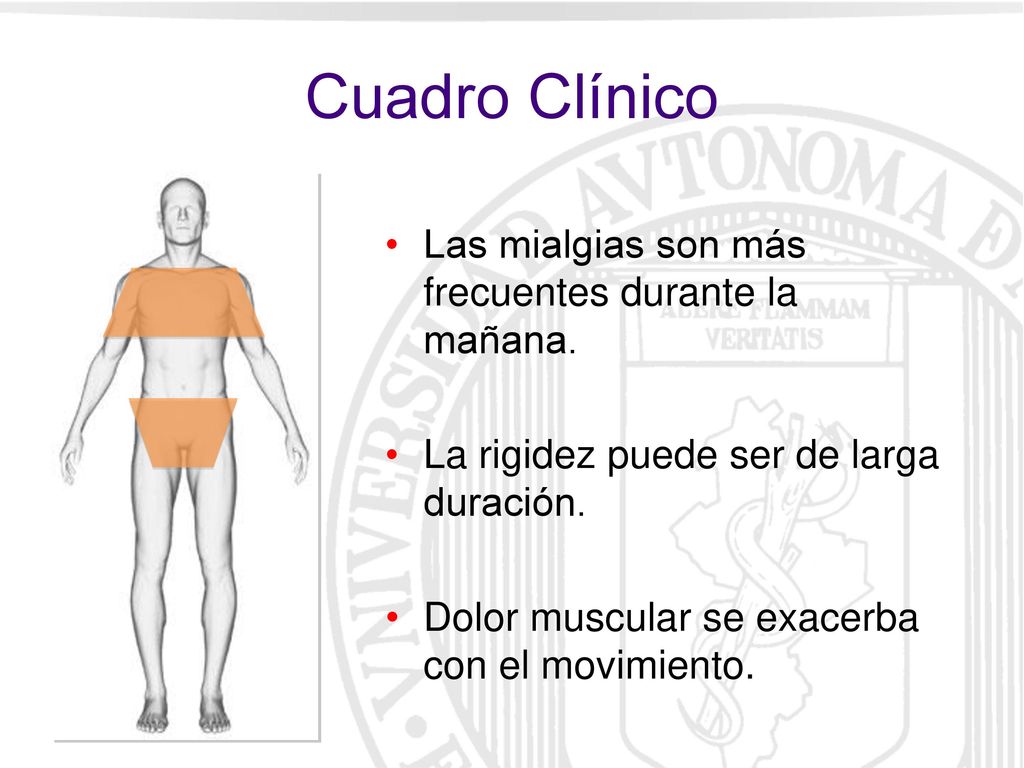 Cuadro Clínico Las mialgias son más frecuentes durante la mañana.