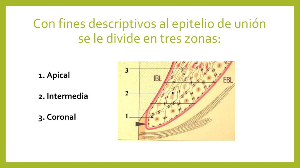 Con fines descriptivos al epitelio de unión se le divide en tres zonas: