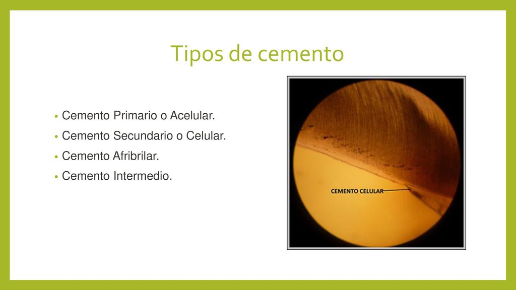 Tipos de cemento Cemento Primario o Acelular.