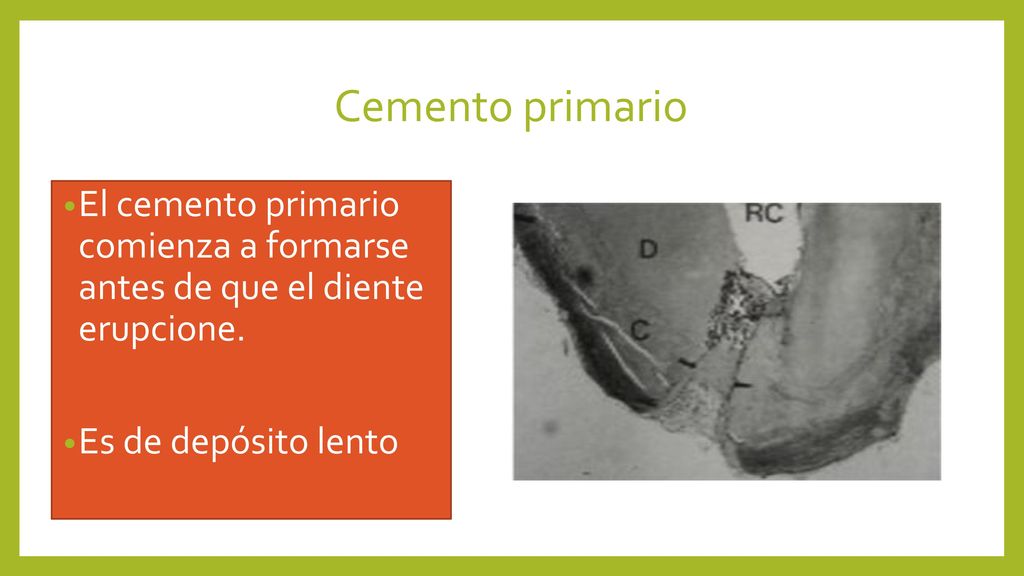 Cemento primario El cemento primario comienza a formarse antes de que el diente erupcione.