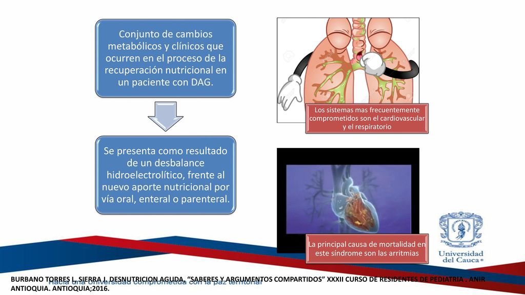 La principal causa de mortalidad en este síndrome son las arritmias