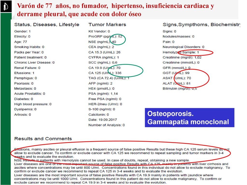 Varón de 77 años, no fumador, hipertenso, insuficiencia cardiaca y derrame pleural, que acude con dolor óseo