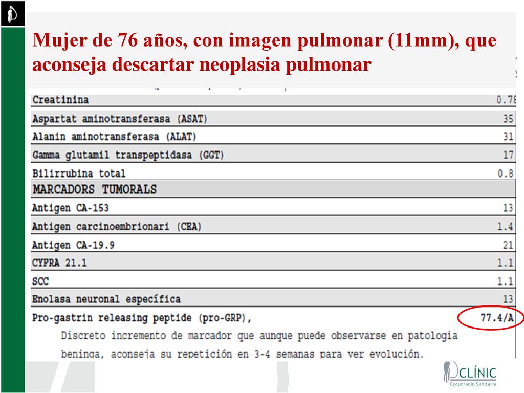 Mujer de 76 años, con imagen pulmonar (11mm), que aconseja descartar neoplasia pulmonar
