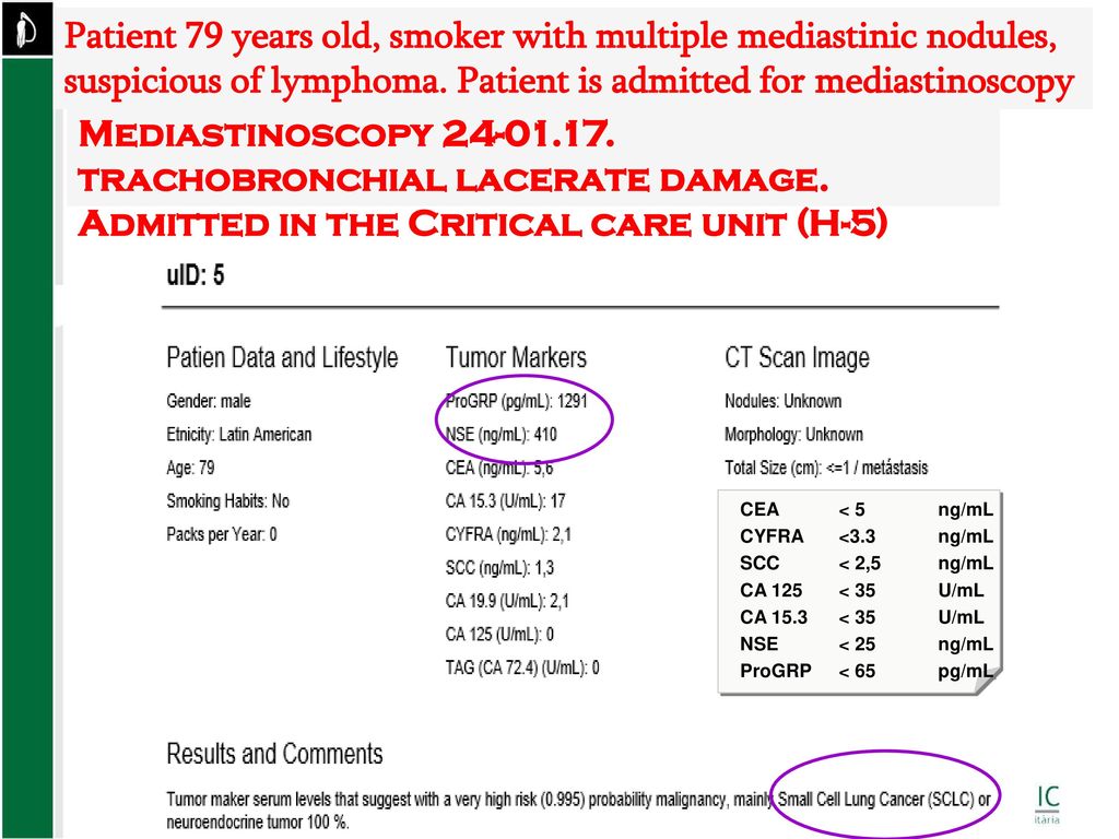 Patient 79 years old, smoker with multiple mediastinic nodules, suspicious of lymphoma. Patient is admitted for mediastinoscopy