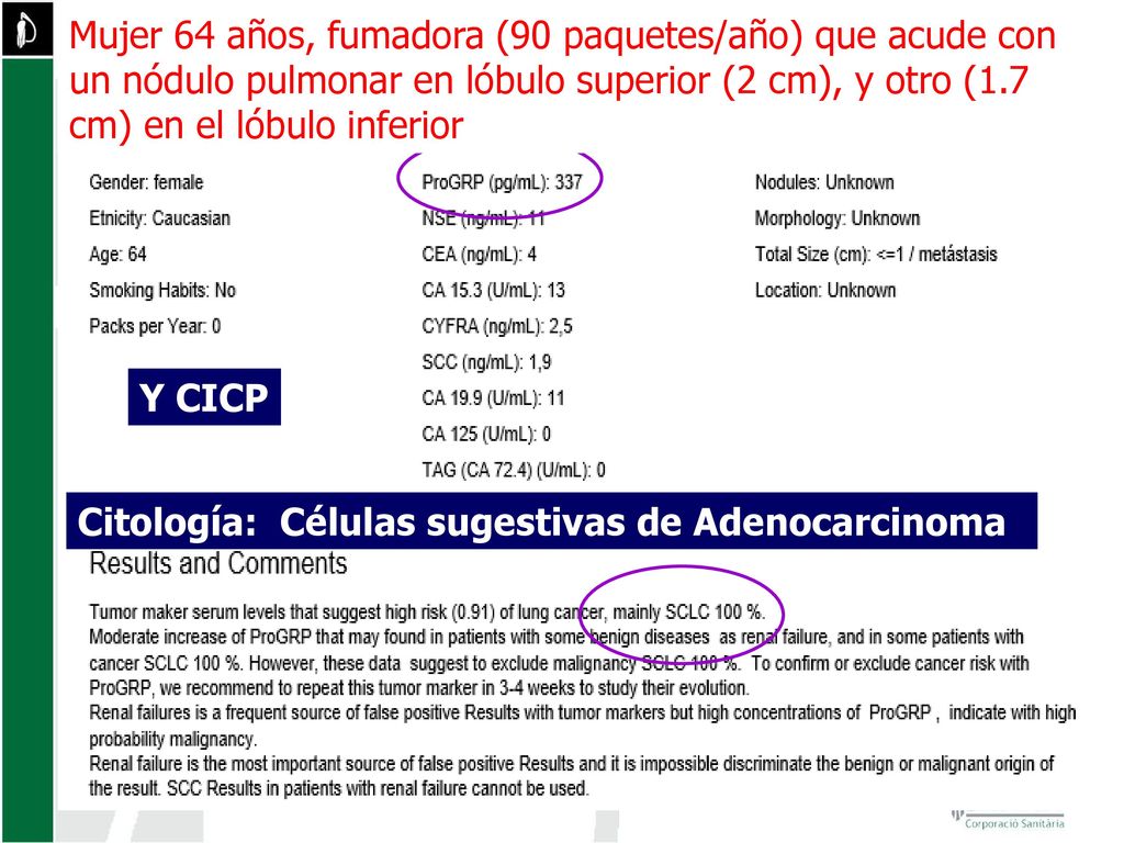 Mujer 64 años, fumadora (90 paquetes/año) que acude con un nódulo pulmonar en lóbulo superior (2 cm), y otro (1.7 cm) en el lóbulo inferior