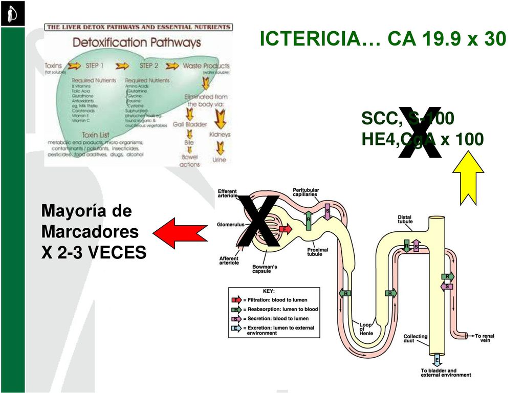 X X ICTERICIA… CA 19.9 x 30 SCC, S-100 HE4,CgA x 100