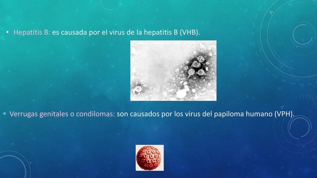 Hepatitis B: es causada por el virus de la hepatitis B (VHB).