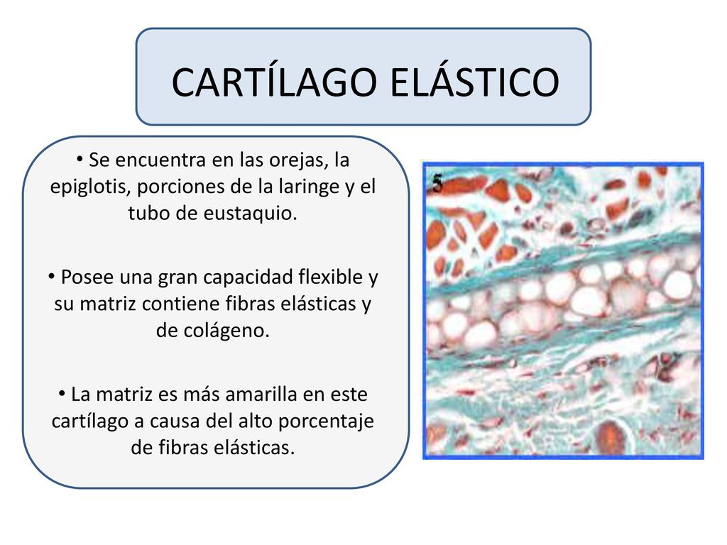 CARTÍLAGO ELÁSTICO Se encuentra en las orejas, la epiglotis, porciones de la laringe y el tubo de eustaquio.