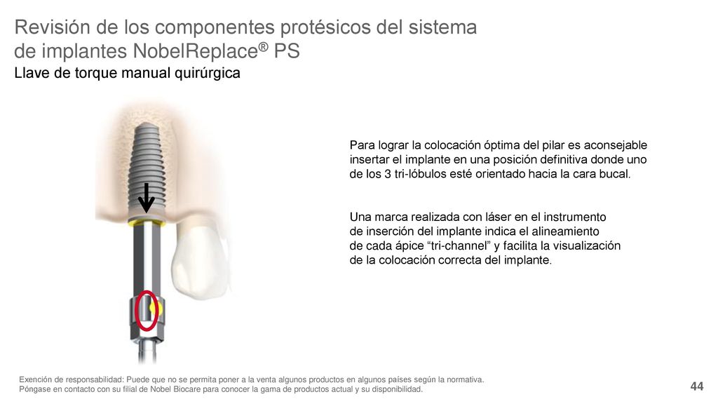 Revisión de los componentes protésicos del sistema de implantes NobelReplace® PS