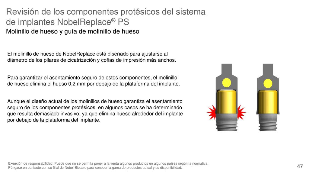 Revisión de los componentes protésicos del sistema de implantes NobelReplace® PS
