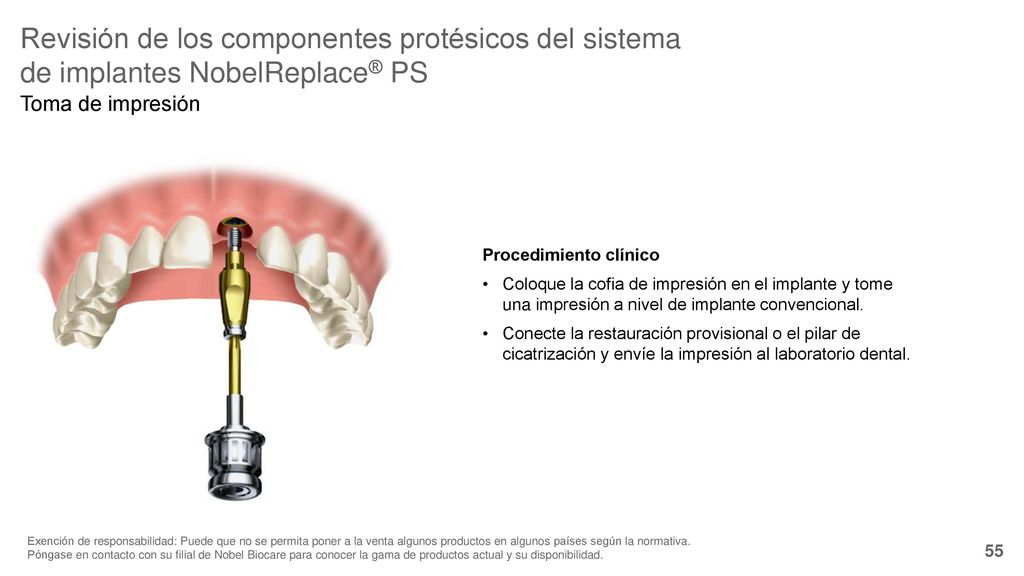 Revisión de los componentes protésicos del sistema de implantes NobelReplace® PS
