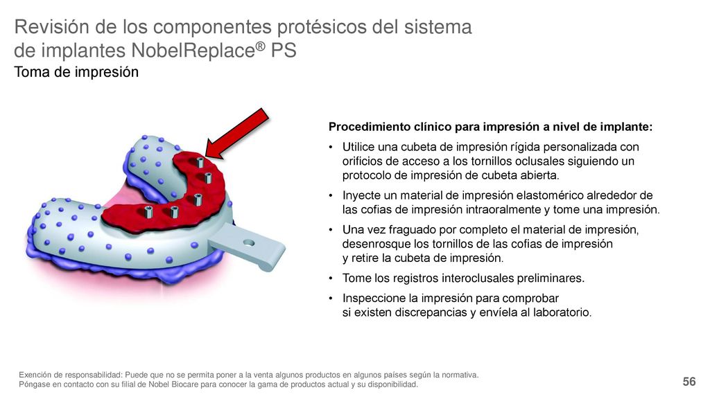 Revisión de los componentes protésicos del sistema de implantes NobelReplace® PS