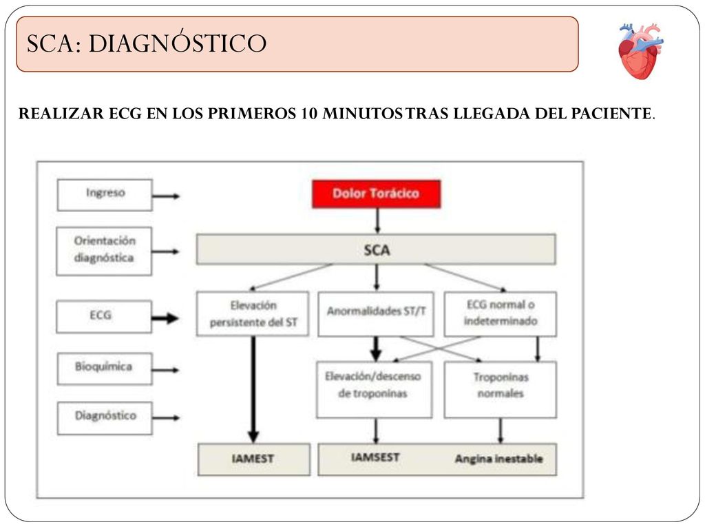 SCA: DIAGNÓSTICO REALIZAR ECG EN LOS PRIMEROS 10 MINUTOS TRAS LLEGADA DEL PACIENTE.