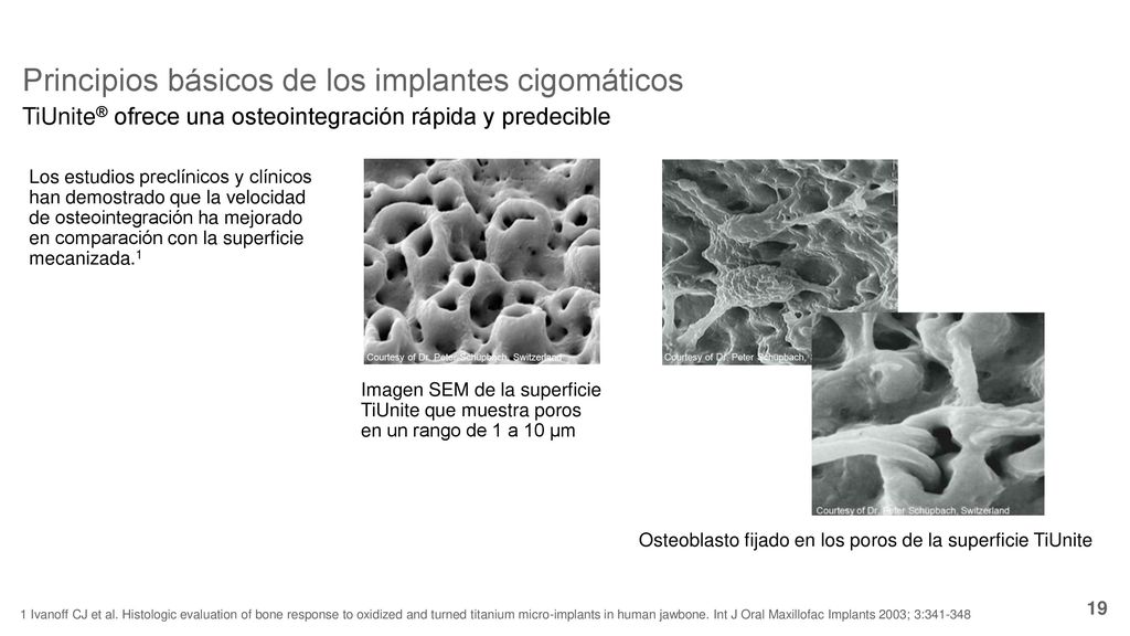 Osteoblasto fijado en los poros de la superficie TiUnite