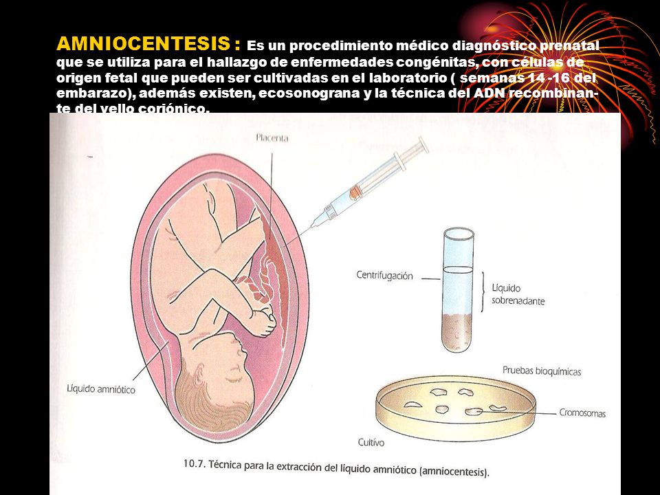 AMNIOCENTESIS : Es un procedimiento médico diagnóstico prenatal que se utiliza para el hallazgo de enfermedades congénitas, con células de origen fetal que pueden ser cultivadas en el laboratorio ( semanas del embarazo), además existen, ecosonograna y la técnica del ADN recombinan- te del vello coriónico.