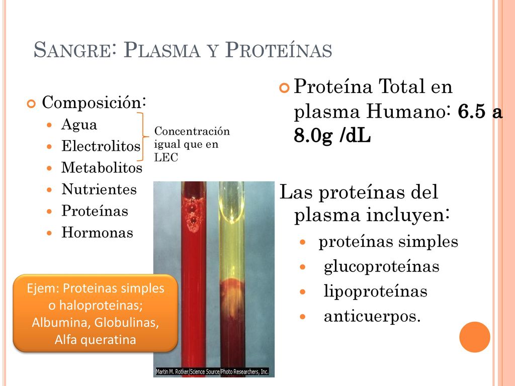 SANGRE: PLASMA plasma Humano: 6.5 a 8.0g /dL Las proteínas del
