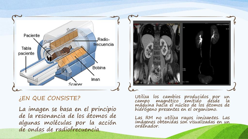 ¿EN QUE CONSISTE La imagen se basa en el principio de la resonancia de los átomos de algunas moléculas por la acción de ondas de radiofrecuencia.