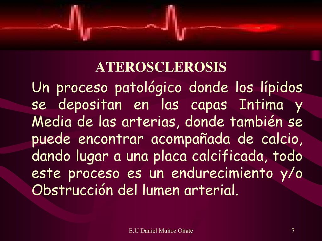 ATEROSCLEROSIS Un proceso patológico donde los lípidos se depositan en las capas Intima y Media de las arterias, donde también se puede encontrar acompañada de calcio, dando lugar a una placa calcificada, todo este proceso es un endurecimiento y/o Obstrucción del lumen arterial.