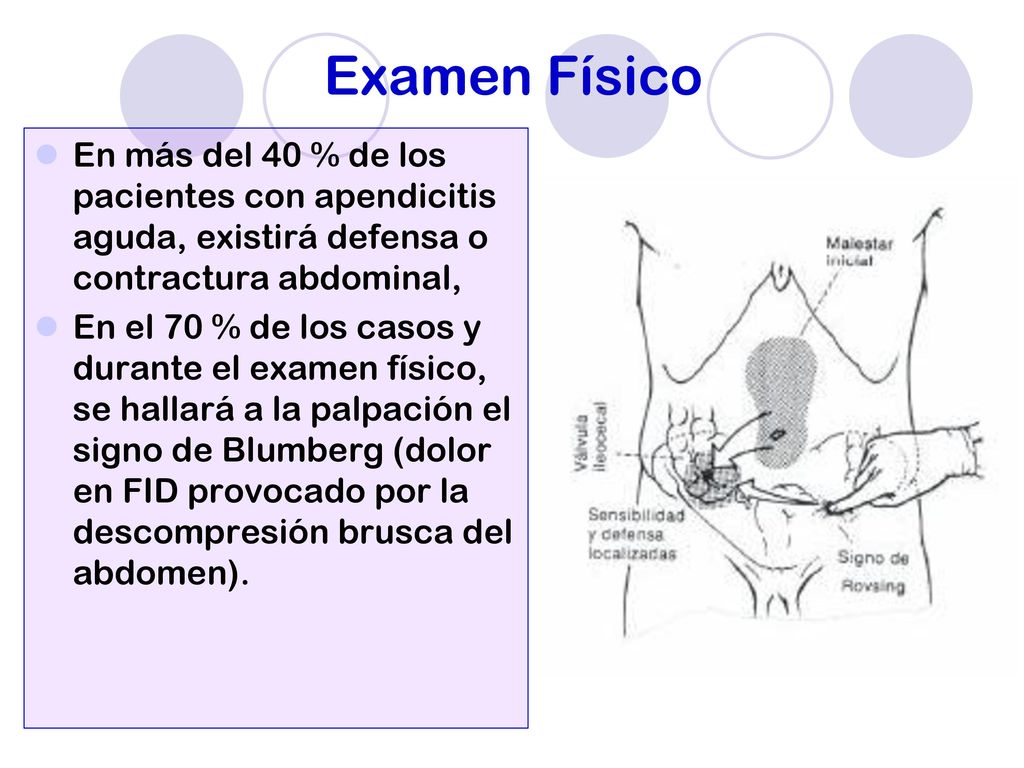 Examen Físico En más del 40 % de los pacientes con apendicitis aguda, existirá defensa o contractura abdominal,