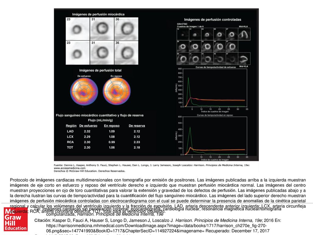 Protocolo de imágenes cardiacas multidimensionales con tomografía por emisión de positrones. Las imágenes publicadas arriba a la izquierda muestran imágenes de eje corto en esfuerzo y reposo del ventrículo derecho e izquierdo que muestran perfusión miocárdica normal. Las imágenes del centro muestran proyecciones en ojo de toro cuantitativas para valorar la extensión y gravedad de los defectos de perfusión. Las imágenes publicadas abajo y a la derecha ilustran las curvas de tiempo/actividad para la cuantificación del flujo sanguíneo miocárdico. Las imágenes del lado superior derecho muestran imágenes de perfusión miocárdica controladas con electrocardiograma con el cual se puede determinar la presencia de anomalías de la cinética parietal regional y calcular los volúmenes del ventrículo izquierdo y la fracción de expulsión. LAD, arteria descendente anterior izquierda; LCX, arteria circunfleja izquierda; RCA, arteria coronaria derecha; TOT, total para el ventrículo izquierdo.