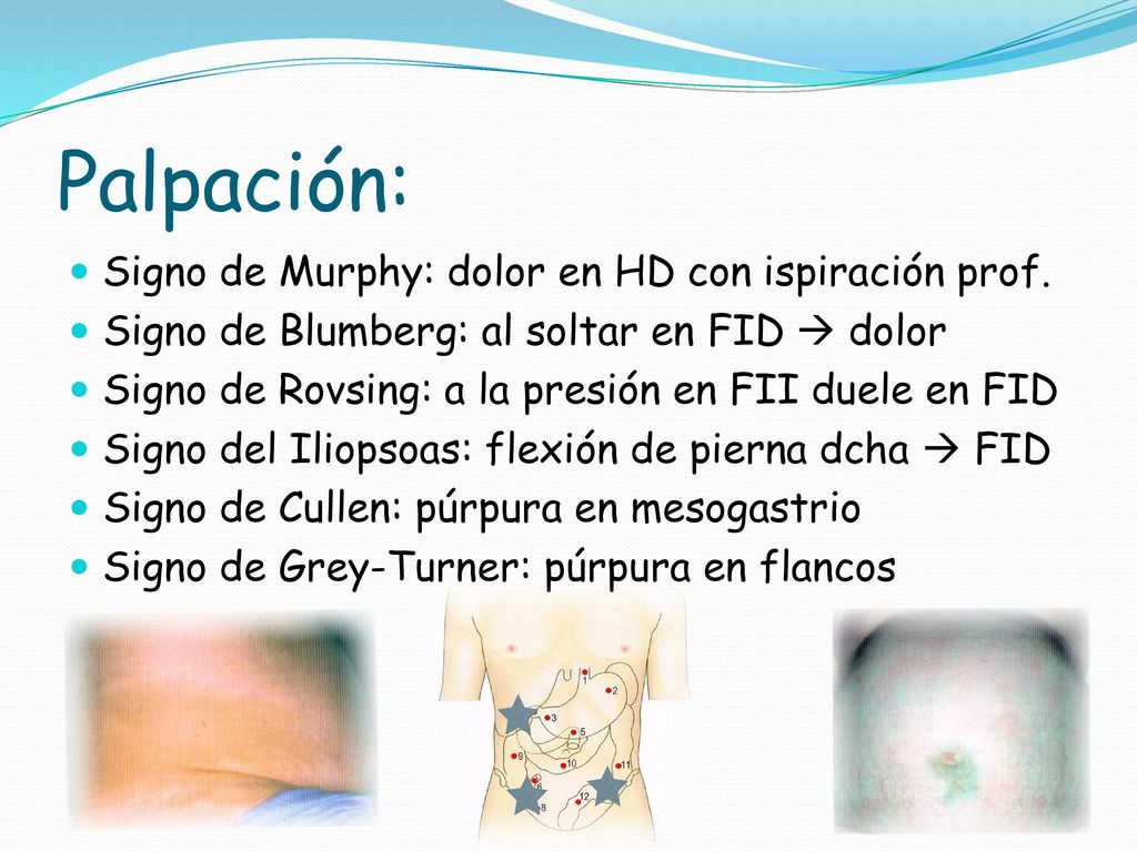 Palpación: Signo de Murphy: dolor en HD con ispiración prof.