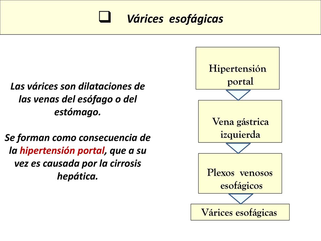 Las várices son dilataciones de las venas del esófago o del estómago.