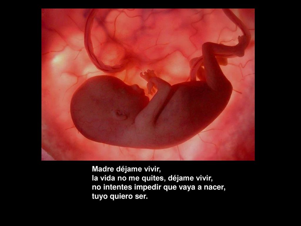 Madre déjame vivir, la vida no me quites, déjame vivir, no intentes impedir que vaya a nacer, tuyo quiero ser.