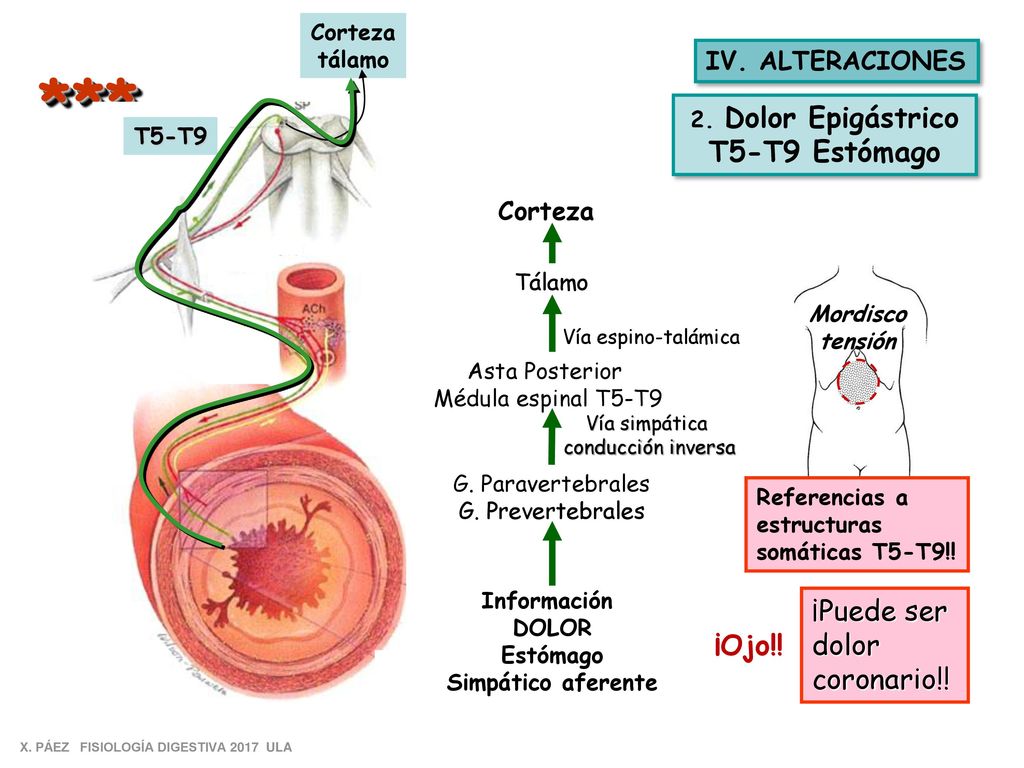 * ** T5-T9 Estómago ¡Puede ser dolor coronario!! ¡Ojo!!