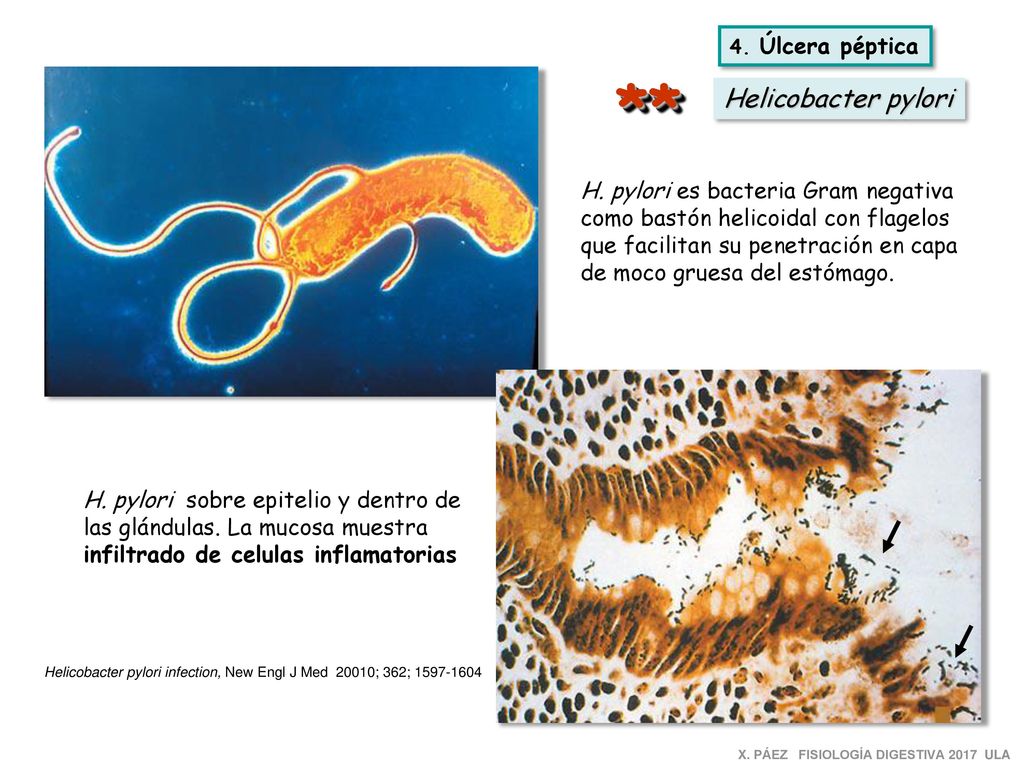 Helicobacter pylori infection, New Engl J Med 20010; 362;