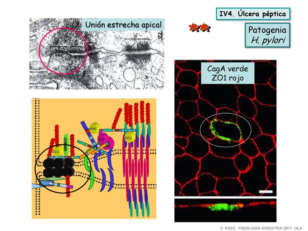 * * Patogenia H. pylori Unión estrecha apical CagA verde ZO1 rojo