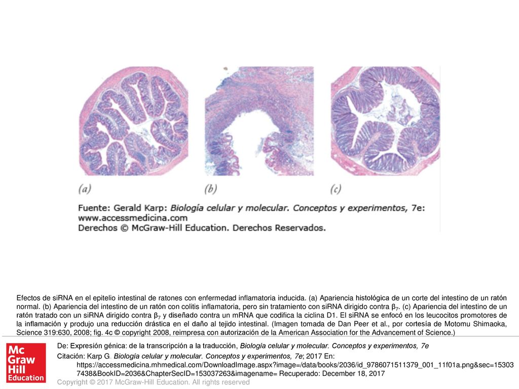 Efectos de siRNA en el epitelio intestinal de ratones con enfermedad inflamatoria inducida. (a) Apariencia histológica de un corte del intestino de un ratón normal. (b) Apariencia del intestino de un ratón con colitis inflamatoria, pero sin tratamiento con siRNA dirigido contra β7. (c) Apariencia del intestino de un ratón tratado con un siRNA dirigido contra β7 y diseñado contra un mRNA que codifica la ciclina D1. El siRNA se enfocó en los leucocitos promotores de la inflamación y produjo una reducción drástica en el daño al tejido intestinal. (Imagen tomada de Dan Peer et al., por cortesía de Motomu Shimaoka, Science 319:630, 2008; fig. 4c © copyright 2008, reimpresa con autorización de la American Association for the Advancement of Science.)