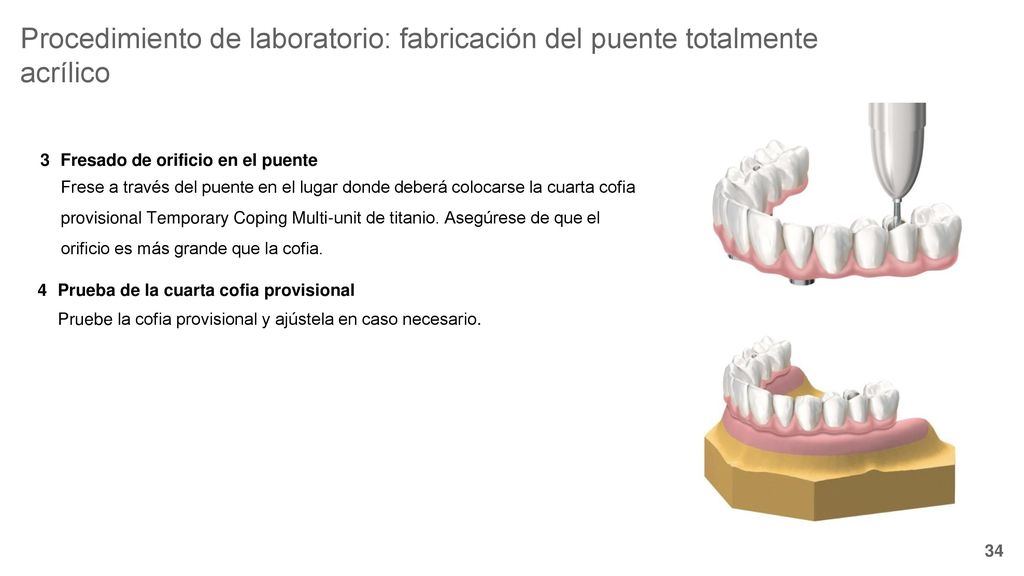 Procedimiento de laboratorio: fabricación del puente totalmente acrílico