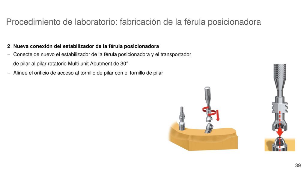 Procedimiento de laboratorio: fabricación de la férula posicionadora