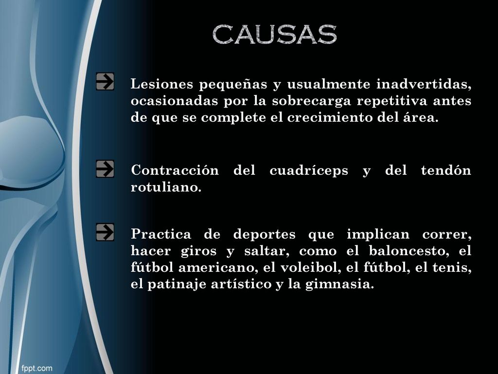 CAUSAS Lesiones pequeñas y usualmente inadvertidas, ocasionadas por la sobrecarga repetitiva antes de que se complete el crecimiento del área.