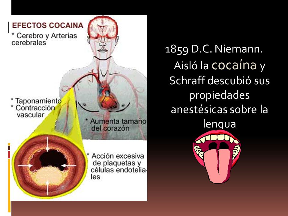 1859 D.C. Niemann. Aisló la cocaína y Schraff descubió sus propiedades anestésicas sobre la lengua