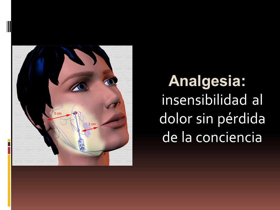Analgesia: insensibilidad al dolor sin pérdida de la conciencia