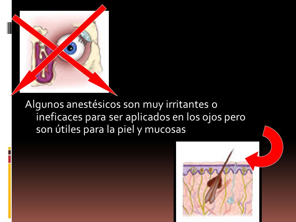 Algunos anestésicos son muy irritantes o ineficaces para ser aplicados en los ojos pero son útiles para la piel y mucosas