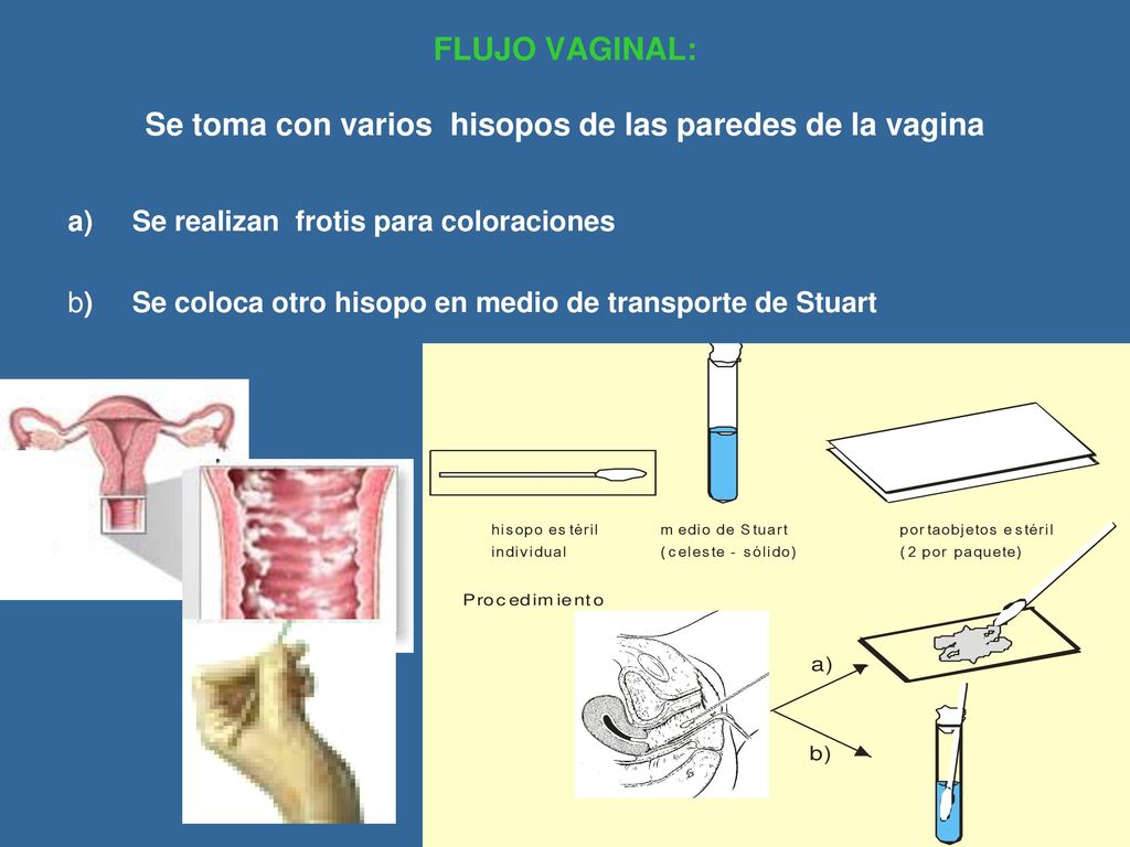 FLUJO VAGINAL: Se toma con varios hisopos de las paredes de la vagina