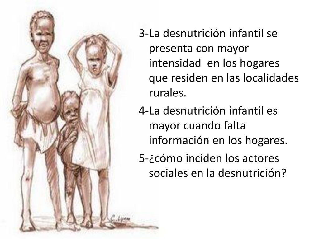 3-La desnutrición infantil se presenta con mayor intensidad en los hogares que residen en las localidades rurales.