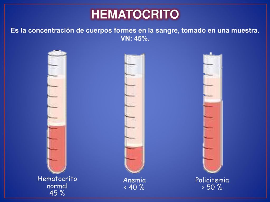 HEMATOCRITO Es la concentración de cuerpos formes en la sangre, tomado en una muestra. VN: 45%. Hematocrito.