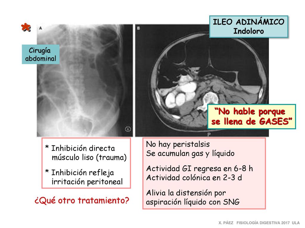 * No hable porque se llena de GASES ¿Qué otro tratamiento